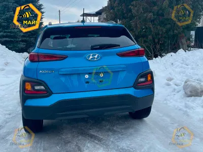 Фото 2 — Hyundai Kona, 2018